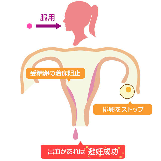アフターピルは排卵や着床を阻害することで避妊効果を発揮
