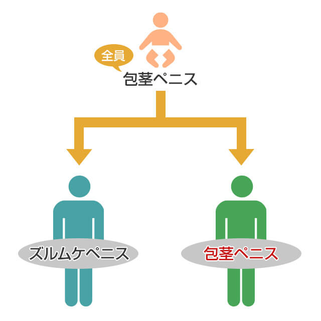 日本人男性は成長するにしたがってズルムケペニスになる人と包茎のままの人に分岐する